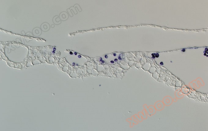 在鸡胚发育的12阶段的血岛