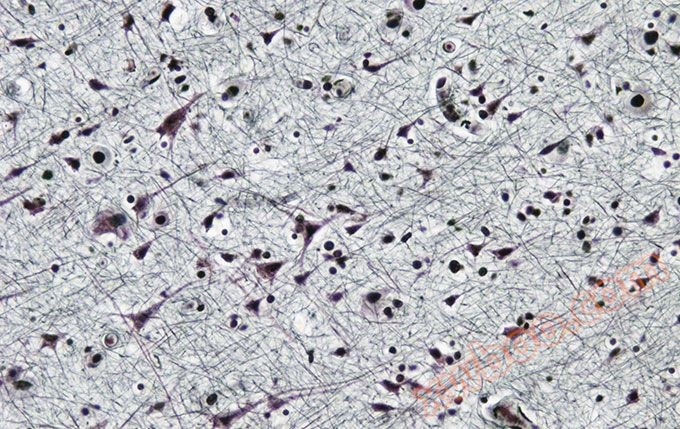 大脑(Bodian染色)